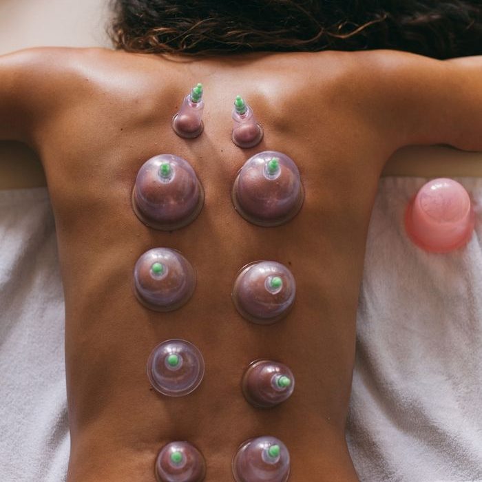 Dry Cupping Therapy In Ghaziabad And Indirapuram